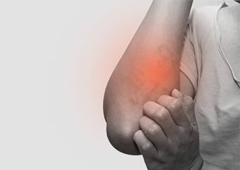 Eczema