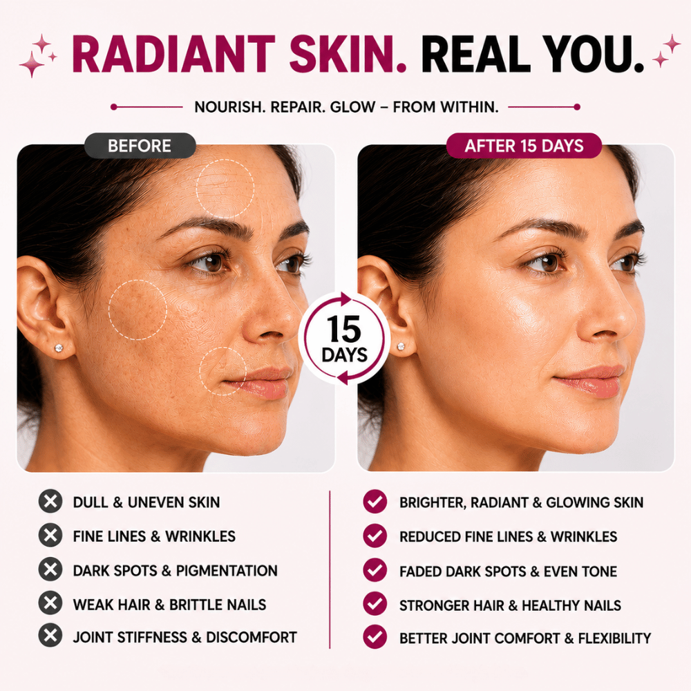 Multi Collagen Complex Type I, II, III, V & X | Skin, Joint & Hair Support | Vedantrum